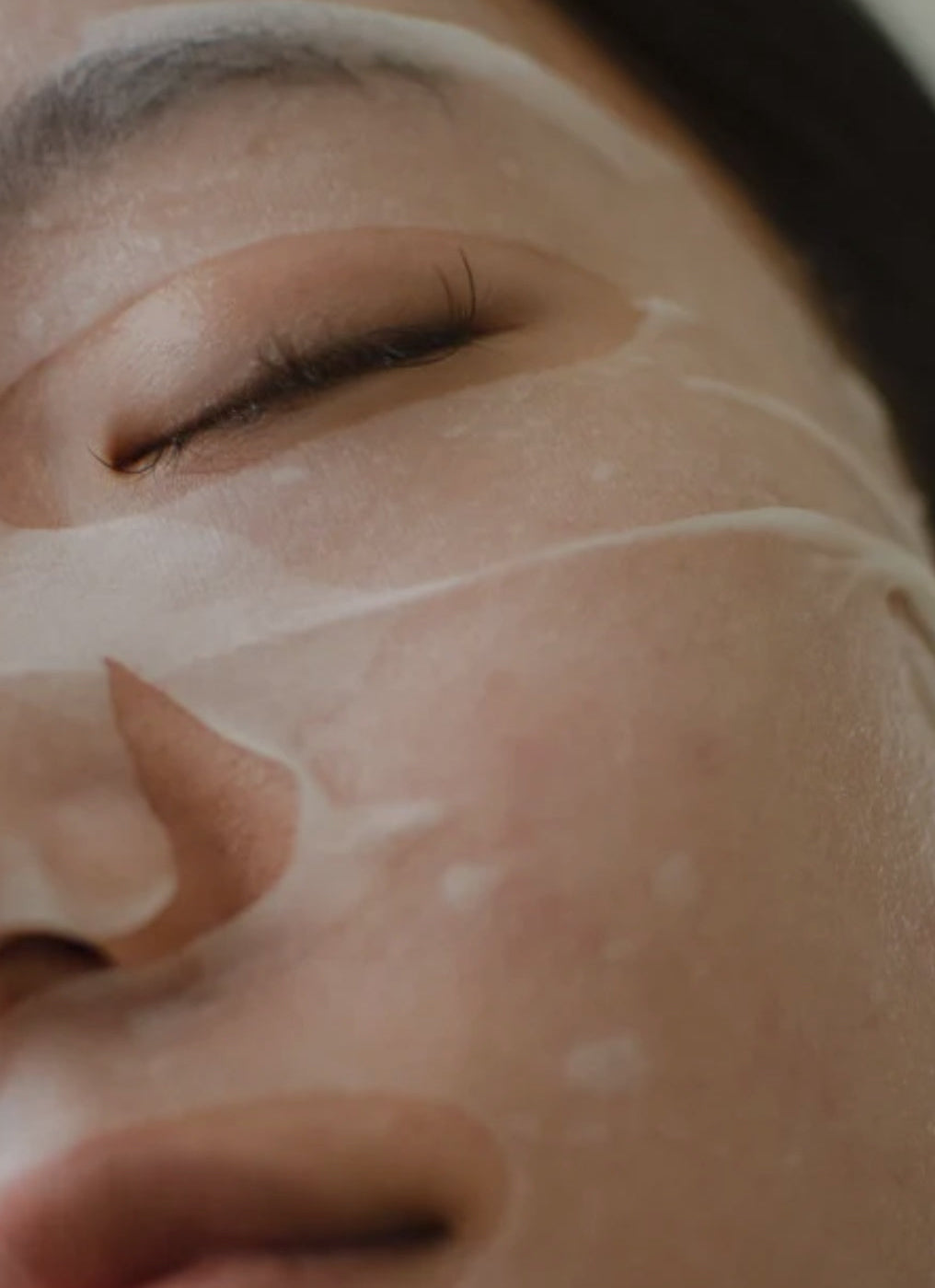 <p>Microneedling</p>